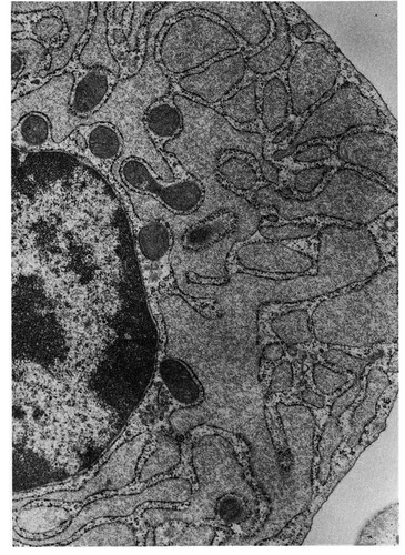 CIL:10775, Cavia porcellus, plasma cell