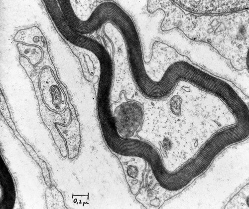 CIL:37219, Rattus, neuron