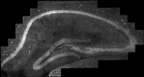 CIL:49651, Mus musculus, C57BL/6, pyramidal cell, central nervous system