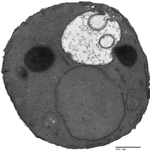 CIL:39696, Saccharomyces cerevisiae, BY4716