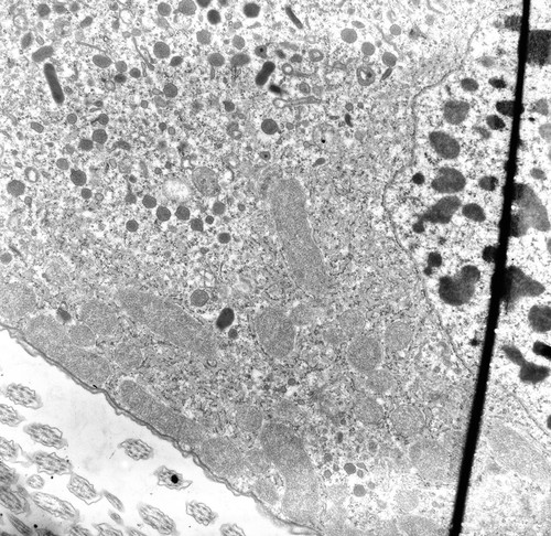 CIL:24921, uncultured Scuticociliatia, Ancistrum sp., cell by organism, eukaryotic cell, Eukaryotic Protist, Ciliated Protist