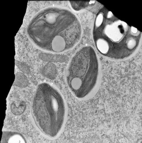 CIL:25697, Trichodina, Chlorella, cell by organism, eukaryotic cell, Eukaryotic Protist, Ciliated Protist