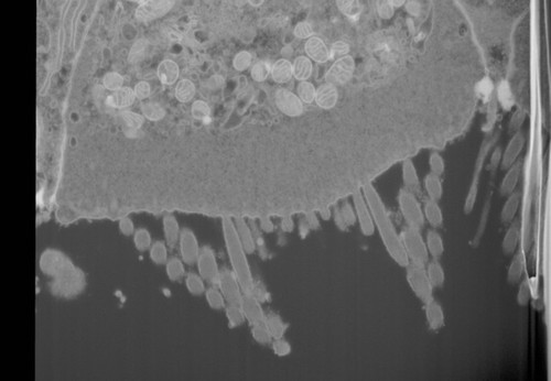 CIL: 50683, FIB-SEM Dataset of anti-PKHD1L1 Immuno-Gold Labeled Outer Hair Cell Stereocilia Bundles