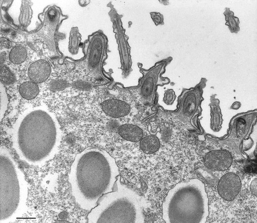 CIL:12978, Paramecium multimicronucleatum, eukaryotic cell, Eukaryotic Protist, Ciliated Protist