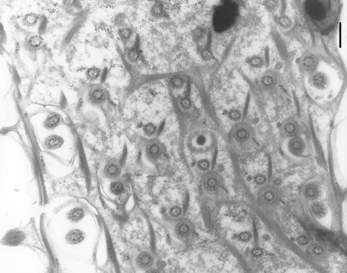 CIL:9845, Paramecium tetraurelia, cell by organism, eukaryotic cell, Eukaryotic Protist, Ciliated Protist