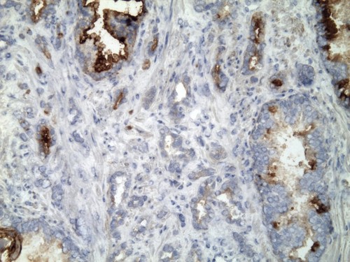 CIL:32197, Homo sapiens, endocrine-paracrine cell of prostate gland, basal cell of prostate epithelium, luminal cell of prostate epithelium, blood vessel endothelial cell, perineural cell, sheath cell, leukocyte, prostate stromal cell, smooth muscle cell of prostate