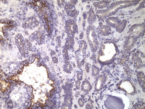 CIL:32627, Homo sapiens, endocrine-paracrine cell of prostate gland, basal cell of prostate epithelium, luminal cell of prostate epithelium, blood vessel endothelial cell, perineural cell, sheath cell, leukocyte, prostate stromal cell, smooth muscle cell of prostate