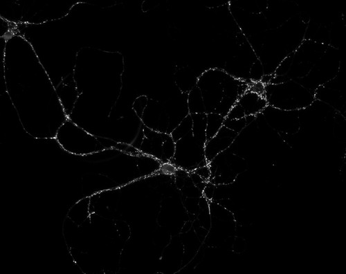 CIL:36163, Rattus, multipolar neuron