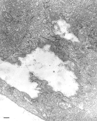 CIL:36752, Paramecium multimicronucleatum, cell by organism, eukaryotic cell, Eukaryotic Protist, Ciliated Protist