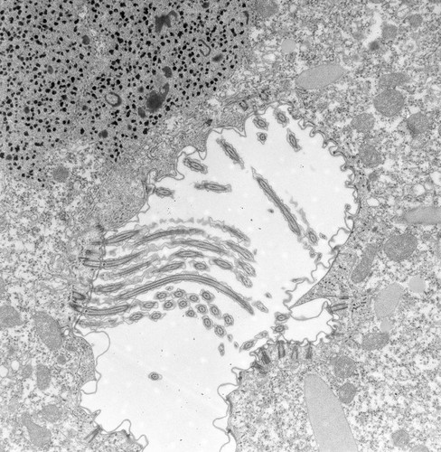 CIL:39156, Paramecium caudatum, cell by organism, eukaryotic cell, Eukaryotic Protist, Ciliated Protist