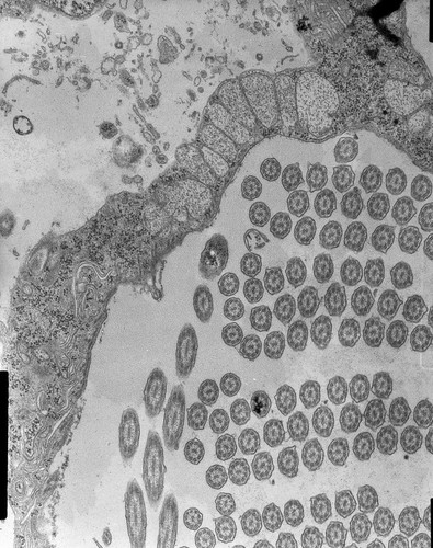CIL:7597, Halteria grandinella, cell by organism, eukaryotic cell, Eukaryotic Protist, Ciliated Protist