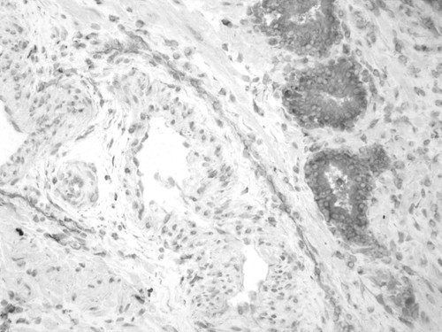 CIL:32390, Homo sapiens, endocrine-paracrine cell of prostate gland, basal cell of prostate epithelium, luminal cell of prostate epithelium, blood vessel endothelial cell, perineural cell, sheath cell, leukocyte, prostate stromal cell, smooth muscle cell of prostate