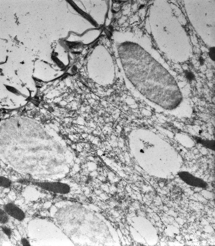 CIL:38686, Paramecium tetraurelia, cell by organism, eukaryotic cell, Eukaryotic Protist, Ciliated Protist