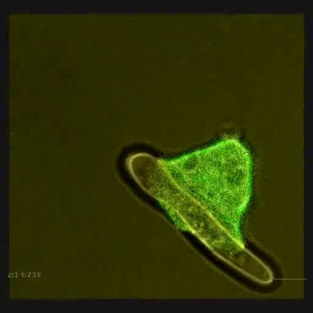 CIL:12654, Dictyostelium discoideum, cell by organism, eukaryotic cell, amoeboid cell, Eukaryotic Protist