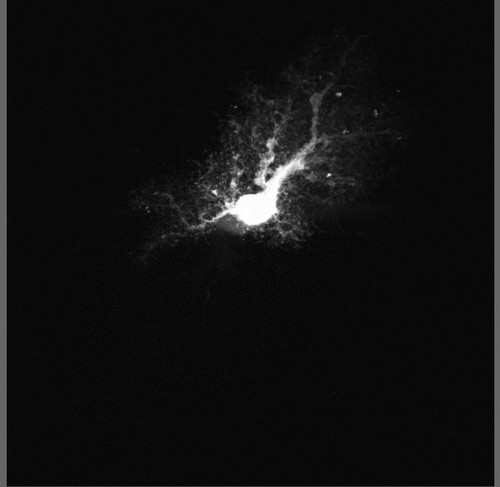 CIL:40025, Rattus, astrocyte, astrocyte of the hippocampus