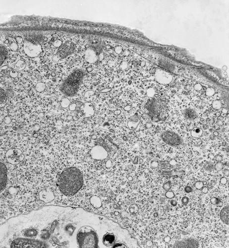 CIL:39516, Vorticella convallaria, cell by organism, eukaryotic cell, Eukaryotic Protist, Ciliated Protist