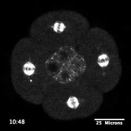 CIL:15790, Strongylocentrotus purpuratus