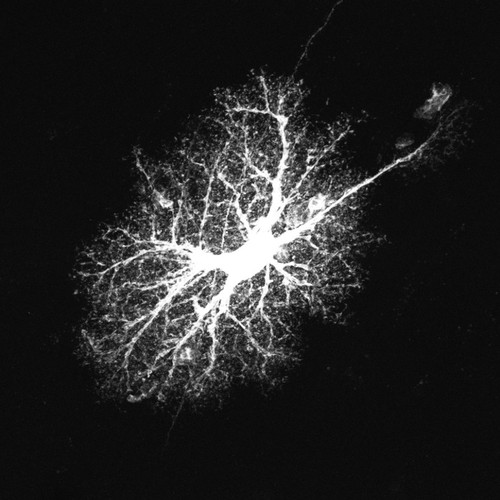 CIL:36359, Rattus norvegicus, astrocyte, astrocyte of the hippocampus