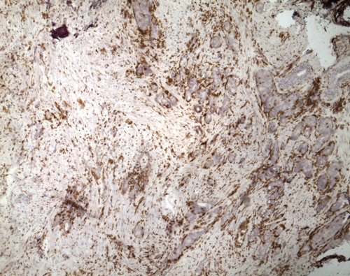 CIL:33241, Homo sapiens, endocrine-paracrine cell of prostate gland, basal cell of prostate epithelium, luminal cell of prostate epithelium, blood vessel endothelial cell, perineural cell, sheath cell, leukocyte, prostate stromal cell, smooth muscle cell of prostate