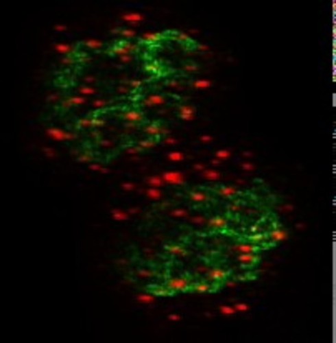 CIL:34517, Homo sapiens, cervical carcinoma