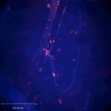 CIL:47533, Staphylococcus aureus, neutrophil, endothelial cell