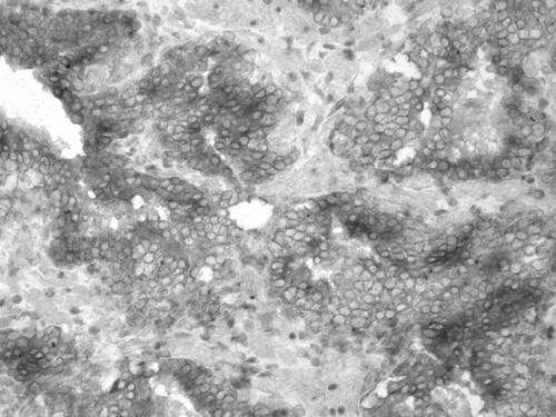 CIL:32251, Homo sapiens, endocrine-paracrine cell of prostate gland, basal cell of prostate epithelium, luminal cell of prostate epithelium, blood vessel endothelial cell, perineural cell, sheath cell, leukocyte, prostate stromal cell, smooth muscle cell of prostate