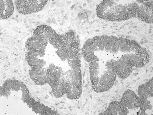 CIL:34266, Homo sapiens, endocrine-paracrine cell of prostate gland, basal cell of prostate epithelium, luminal cell of prostate epithelium, blood vessel endothelial cell, perineural cell, sheath cell, leukocyte, prostate stromal cell, smooth muscle cell of prostate