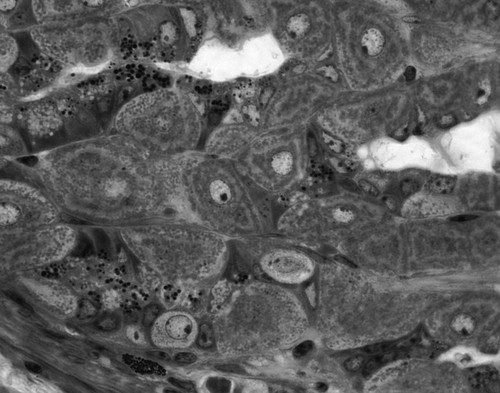 CIL:49006, Mus musculus, parietal cell, zymogen, mucus