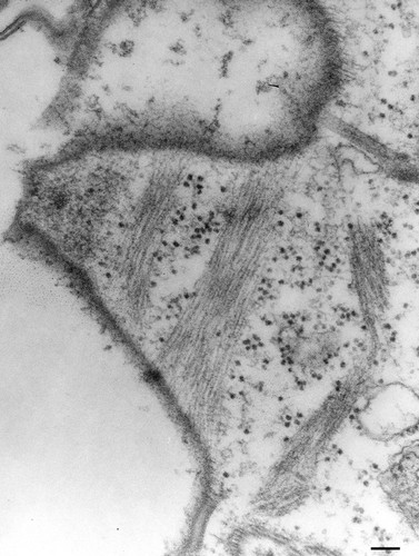 CIL:36596, Paramecium multimicronucleatum, cell by organism, eukaryotic cell, Eukaryotic Protist, Ciliated Protist