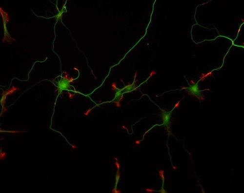 CIL:10106, Rattus, multipolar neuron