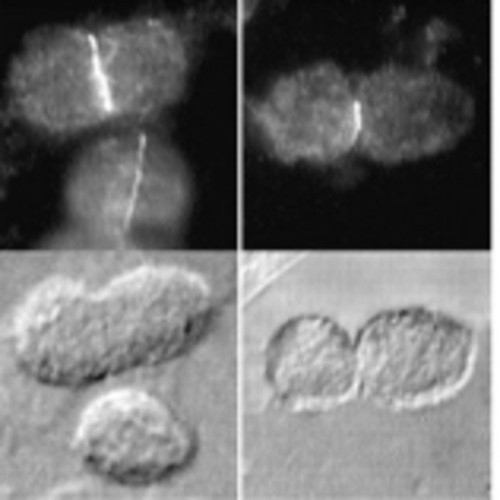 CIL:38855, Arabidopsis thaliana, leaf