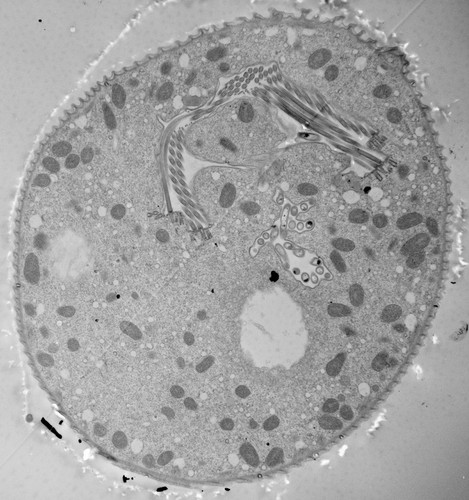 CIL:40571, Vorticella convallaria, cell by organism, eukaryotic cell, Eukaryotic Protist, Ciliated Protist