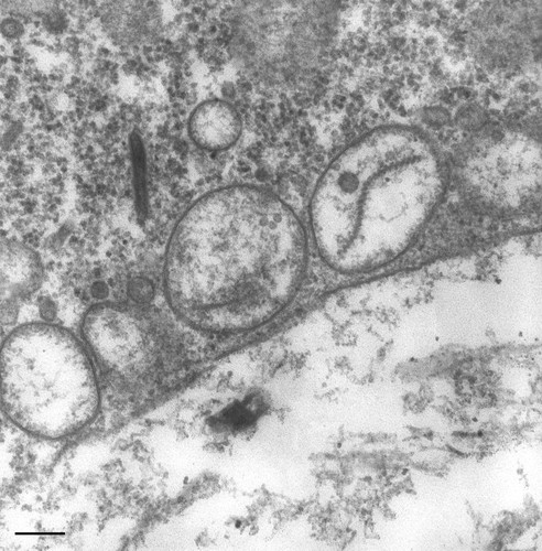 CIL:36739, Paramecium multimicronucleatum, cell by organism, eukaryotic cell, Eukaryotic Protist, Ciliated Protist