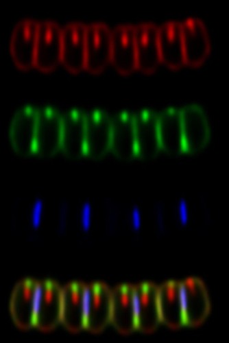 CIL: 54825, Alysiella filiformis, bacteria