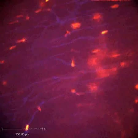 CIL:47531, Staphylococcus aureus, neutrophil, endothelial cell