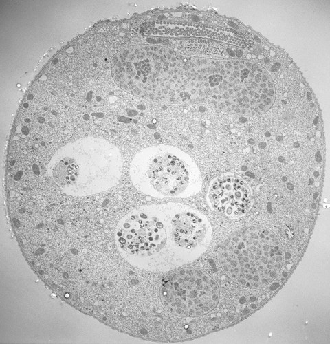 CIL:39405, Vorticella convallaria, cell by organism, eukaryotic cell, Eukaryotic Protist, Ciliated Protist