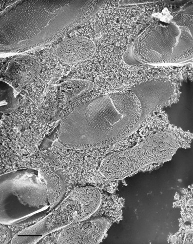 CIL:36679, Paramecium multimicronucleatum, cell by organism, eukaryotic cell, Eukaryotic Protist, Ciliated Protist