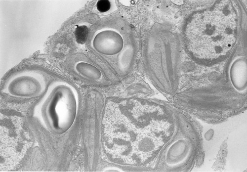 CIL:571, Acetabularia mediterranea, gamete