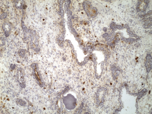 CIL:32551, Homo sapiens, endocrine-paracrine cell of prostate gland, basal cell of prostate epithelium, luminal cell of prostate epithelium, blood vessel endothelial cell, perineural cell, sheath cell, leukocyte, prostate stromal cell, smooth muscle cell of prostate