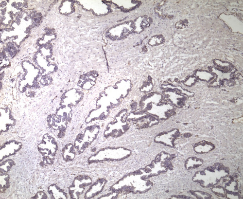 CIL:32635, Homo sapiens, endocrine-paracrine cell of prostate gland, basal cell of prostate epithelium, luminal cell of prostate epithelium, blood vessel endothelial cell, perineural cell, sheath cell, leukocyte, prostate stromal cell, smooth muscle cell of prostate