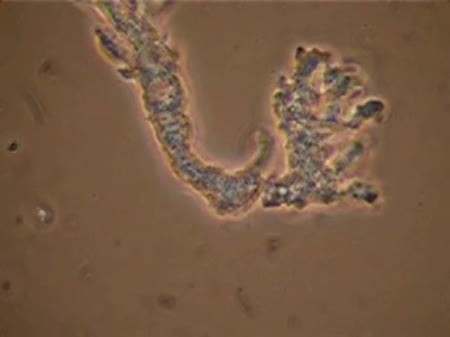 CIL:19325, Balamuthia mandrillaris, cell by organism, eukaryotic cell, Eukaryotic Protist, Amoeboid Protist