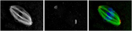 CIL:35431, Mus musculus, oocyte