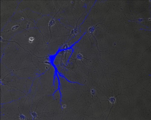 CIL:846, Rattus, multipolar neuron