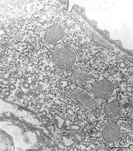 CIL:36256, Vorticella convallaria, cell by organism, eukaryotic cell, Eukaryotic Protist, Ciliated Protist