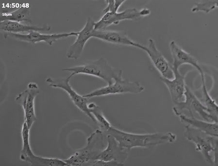 CIL:31926, Homo sapiens, retinal pigment epithelium