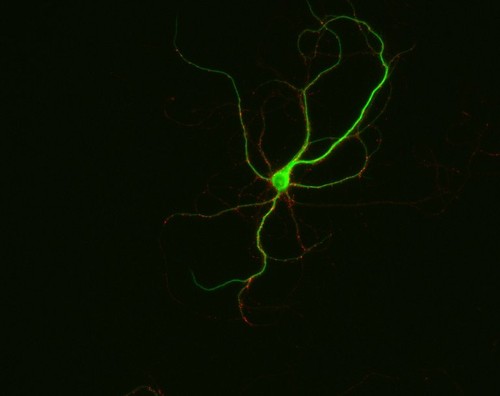 CIL:12547, Rattus, multipolar neuron