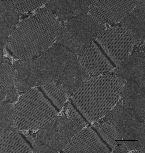 CIL:34563, Drosophila melanogaster, flight muscle cell