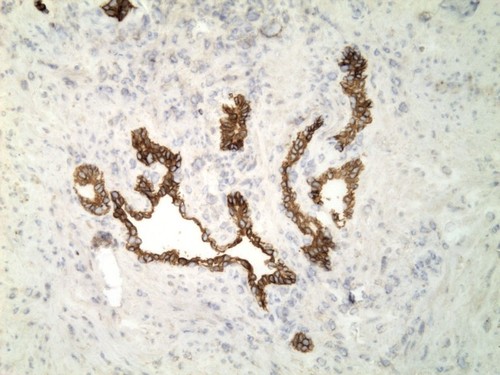 CIL:34271, Homo sapiens, endocrine-paracrine cell of prostate gland, basal cell of prostate epithelium, luminal cell of prostate epithelium, blood vessel endothelial cell, perineural cell, sheath cell, leukocyte, prostate stromal cell, smooth muscle cell of prostate