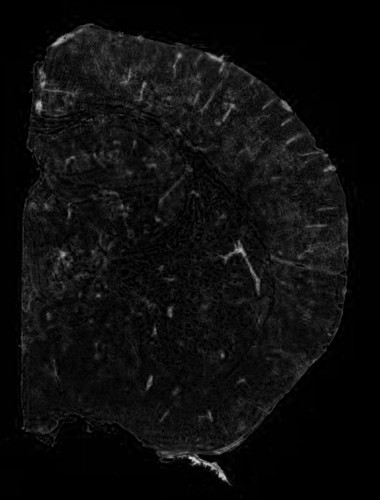 CIL:40234, Mus musculus, CNS neuron (sensu Vertebrata), glial cell, blood vessel endothelial cell