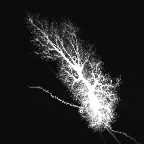 CIL:36367, Rattus norvegicus, astrocyte, astrocyte of the hippocampus